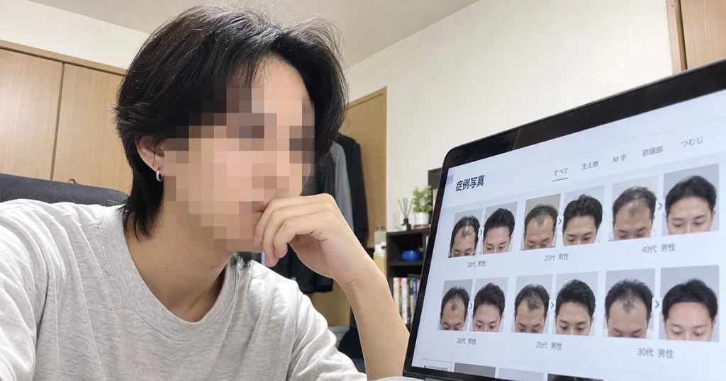 症例を見比べて「ここしかない」と決めたのイメージ画像