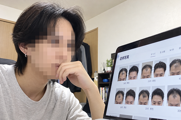 症例を見比べて「ここしかない」と決めたのイメージ画像