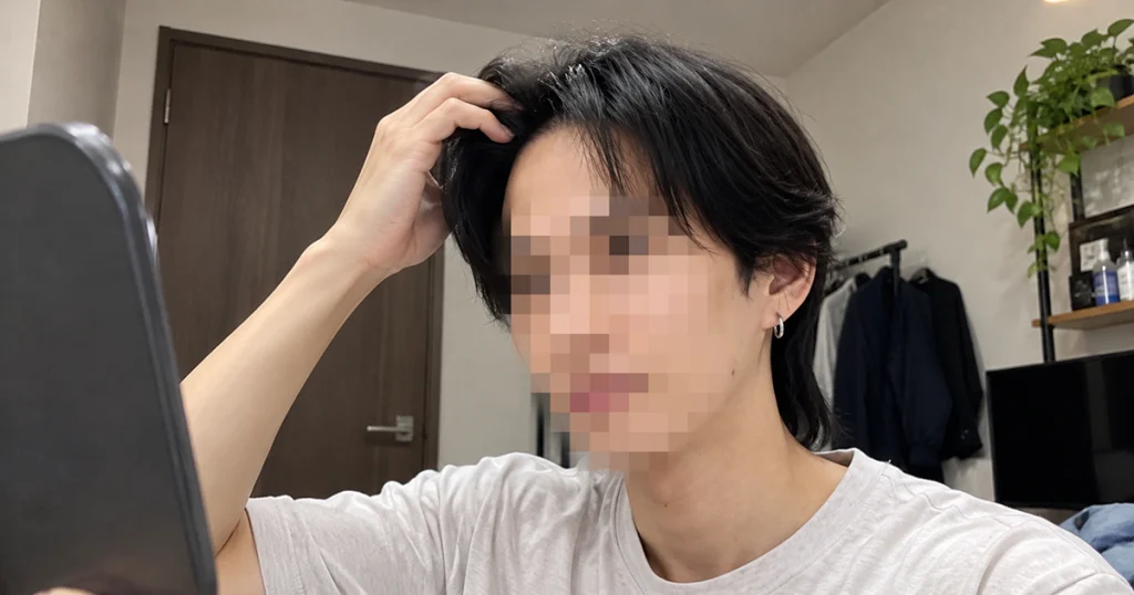 術後1年「本当にやってよかった」と感じてる人もいるのイメージ画像