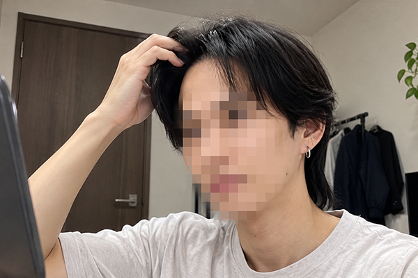 術後1年「本当にやってよかった」と感じてる人もいるのイメージ画像