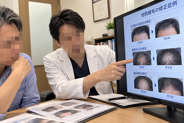 他院・海外植毛の修正にも対応しているのイメージ画像