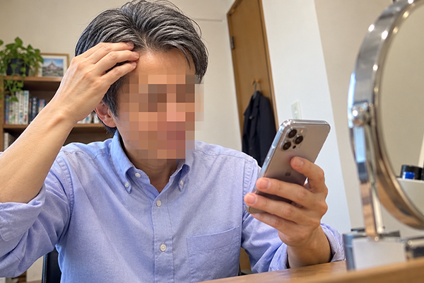 アルモ形成クリニックの植毛のメリット・魅力のイメージ画像