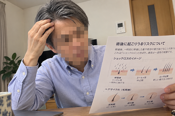 ショックロスなどのリスクもあるのイメージ画像