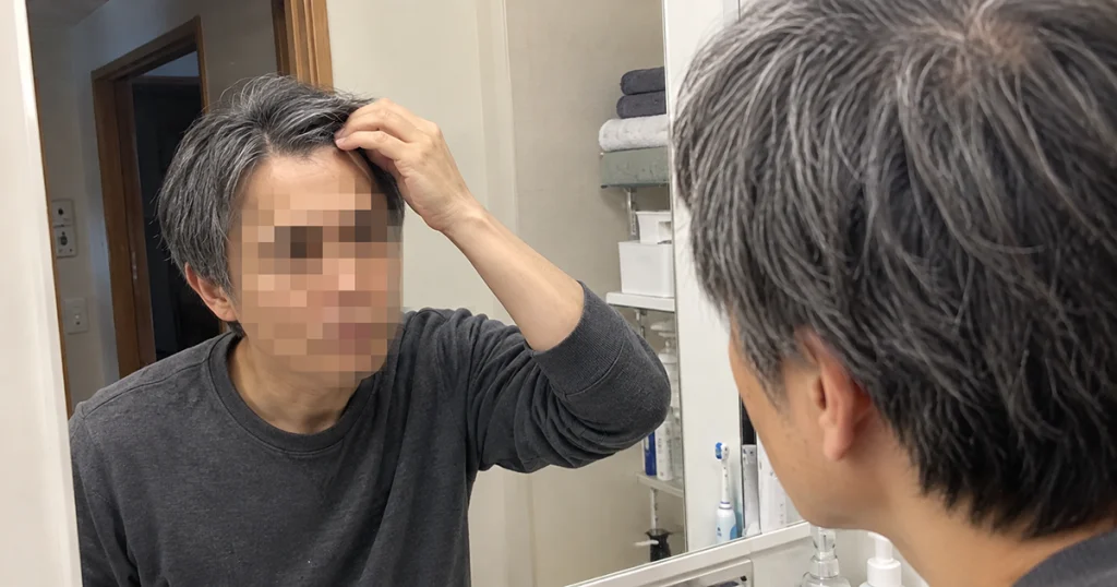 抜け毛・薄毛の進行をなんとかしたいのかのイメージ画像