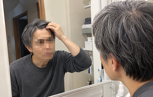 抜け毛・薄毛の進行をなんとかしたいのかのイメージ画像