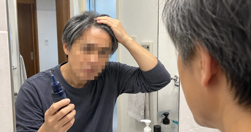 育毛剤｜まず自宅でケアしたい人のイメージ画像