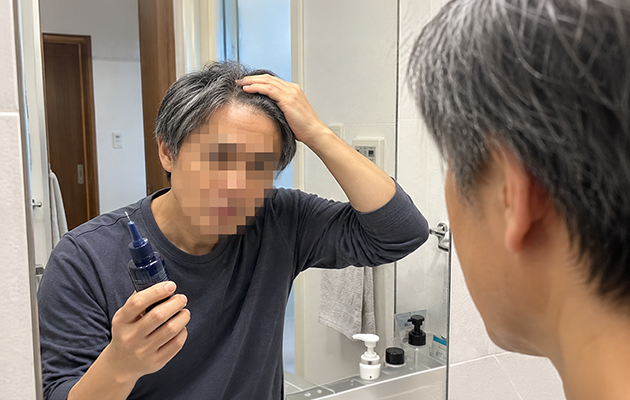 育毛剤｜まず自宅でケアしたい人のイメージ画像